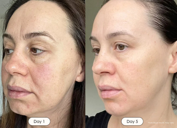 LumiGlow™ 4-in-1 Skincare Wand